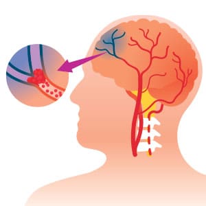 Illustration of the brain
