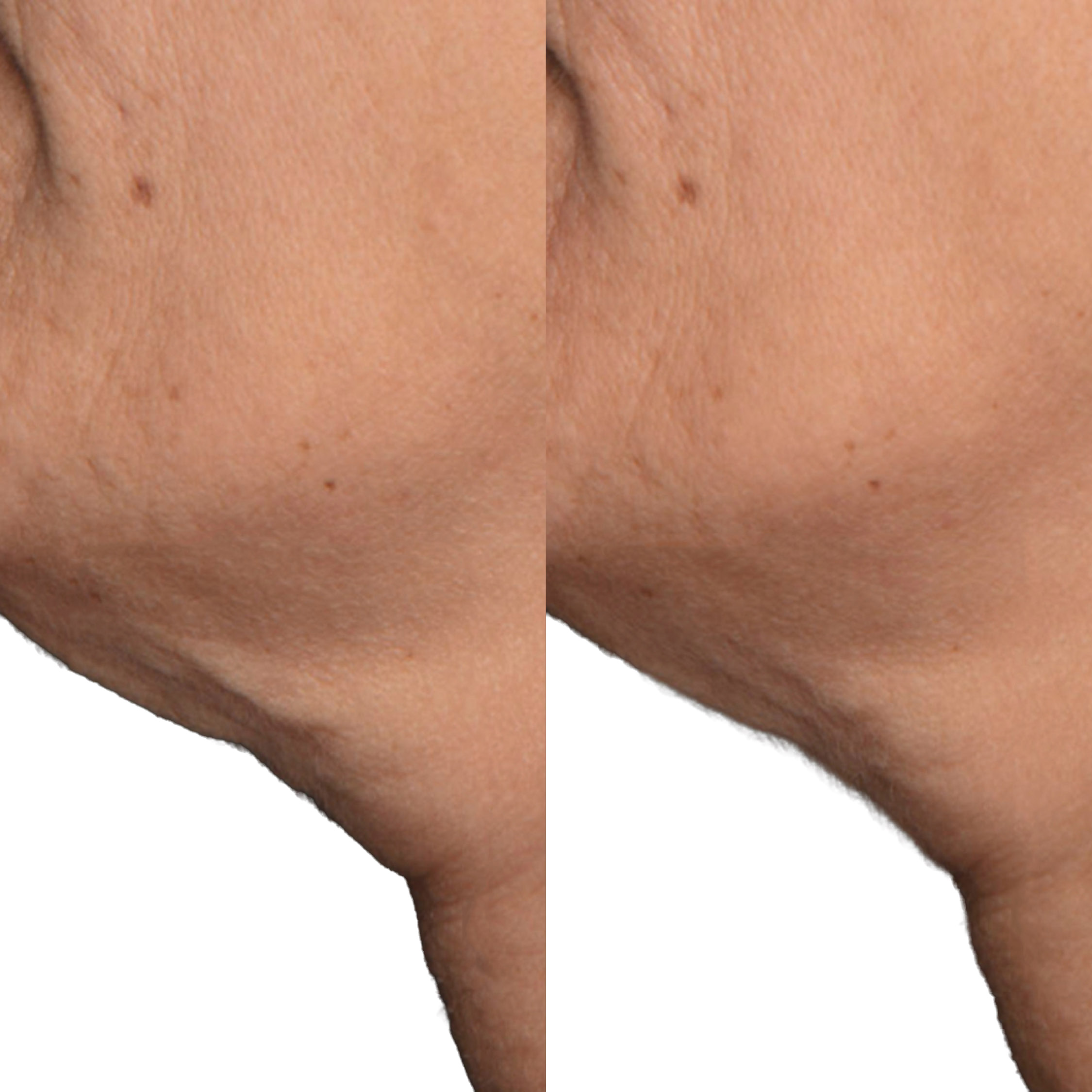 Dr. Brandt Neck Tightening Cream with Gua Sha Tool, 1.7 fl oz | Costco