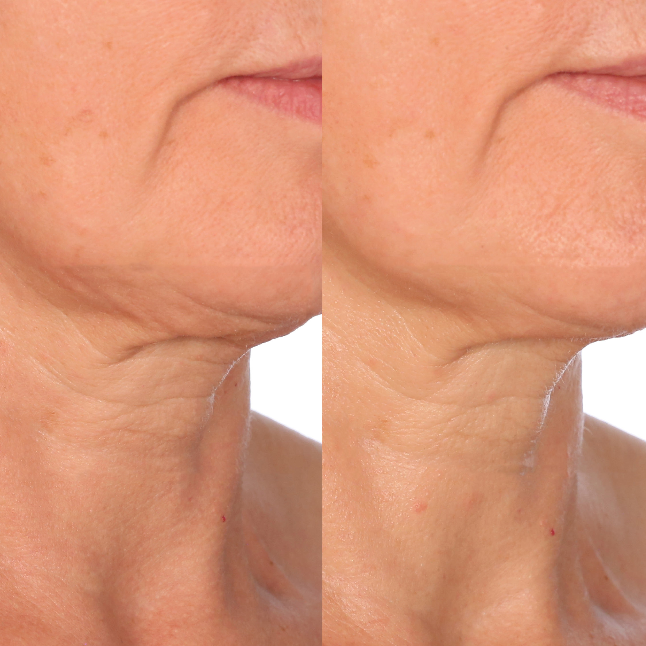 Dr. Brandt Neck Tightening Cream with Gua Sha Tool, 1.7 fl oz | Costco